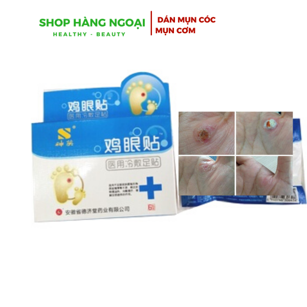 Miếng dán mụn cóc, mụn cơm, mắt cá chân, vết chai chân, cồi cá