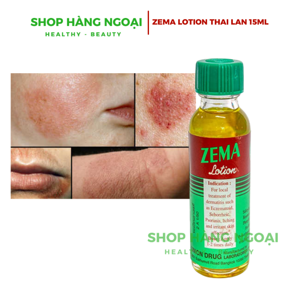 Zema lotion 15ml - Vảy nến, viêm da, eczema